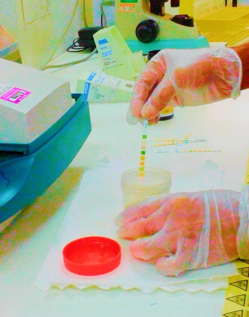 Membaca strip tes urine