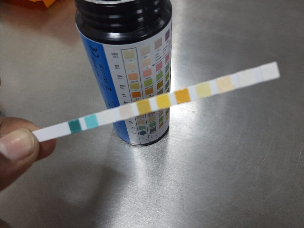 Tangan memegang strip urine dengan kotak-kotak warna untuk berbagai pemeriksaan, di depan botol bagan warna