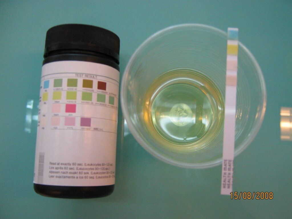 Strip celup urine di samping gelas berisi urine dan botol berisi bagan warna untuk membaca hasil
