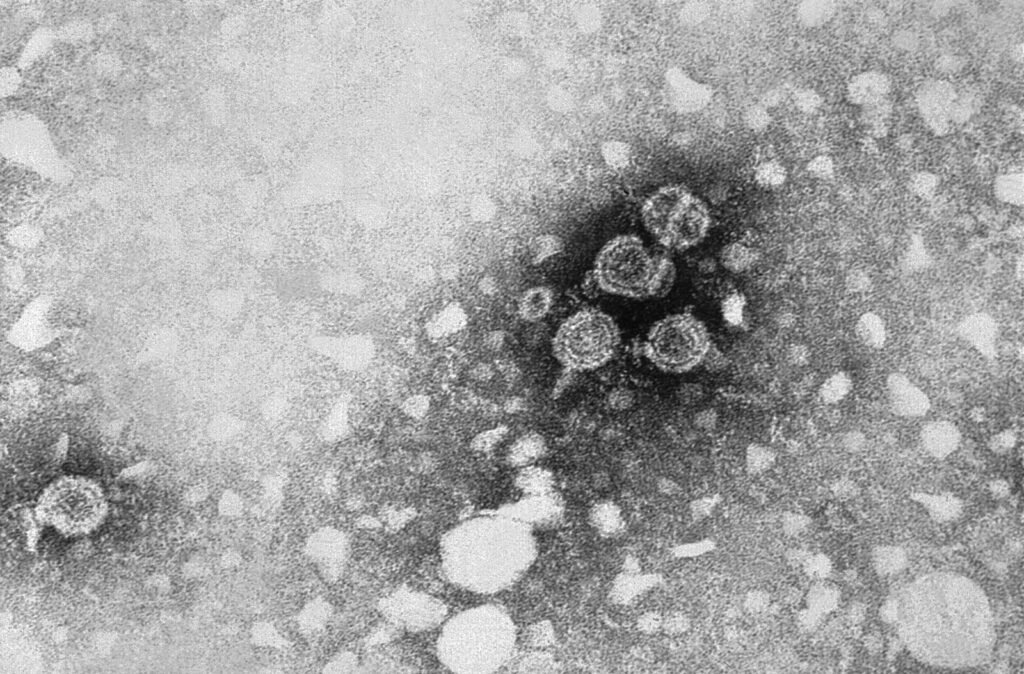 Foto mikroskop elektron partikel virus hepatitis B