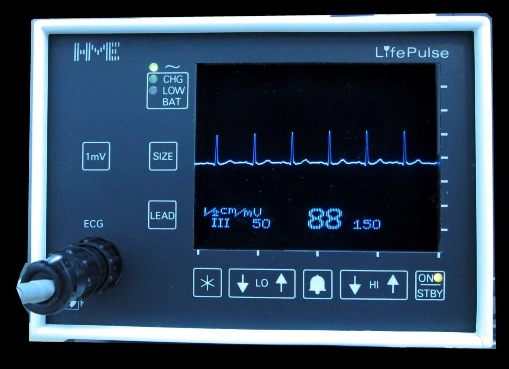 Rekaman irama jantung (EKG) pada monitor, pemeriksaan yang dipakai dokter saat kalium terlalu tinggi atau rendah