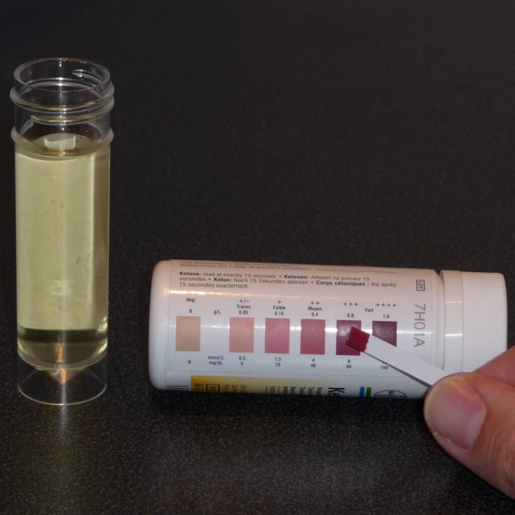 Strip keton yang berubah warna ungu setelah dicelup urine, dicocokkan dengan bagan warna di botol