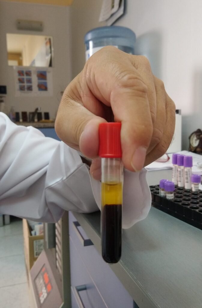 Tabung darah dengan serum kuning terpisah di atas sel darah merah, sampel untuk pemeriksaan elektrolit