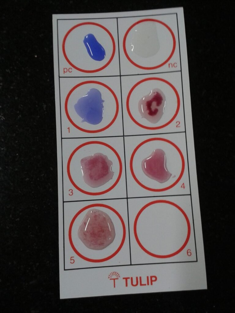 Slide tes Widal dengan beberapa lingkaran berisi campuran serum dan antigen, sebagian tampak menggumpal