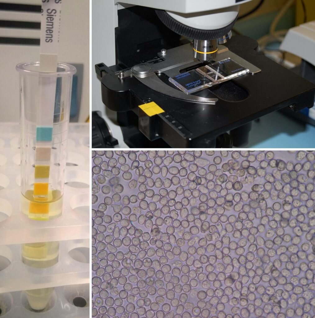 Kolase pemeriksaan urine: sampel urine, strip celup, dan gambaran mikroskopis endapan urine